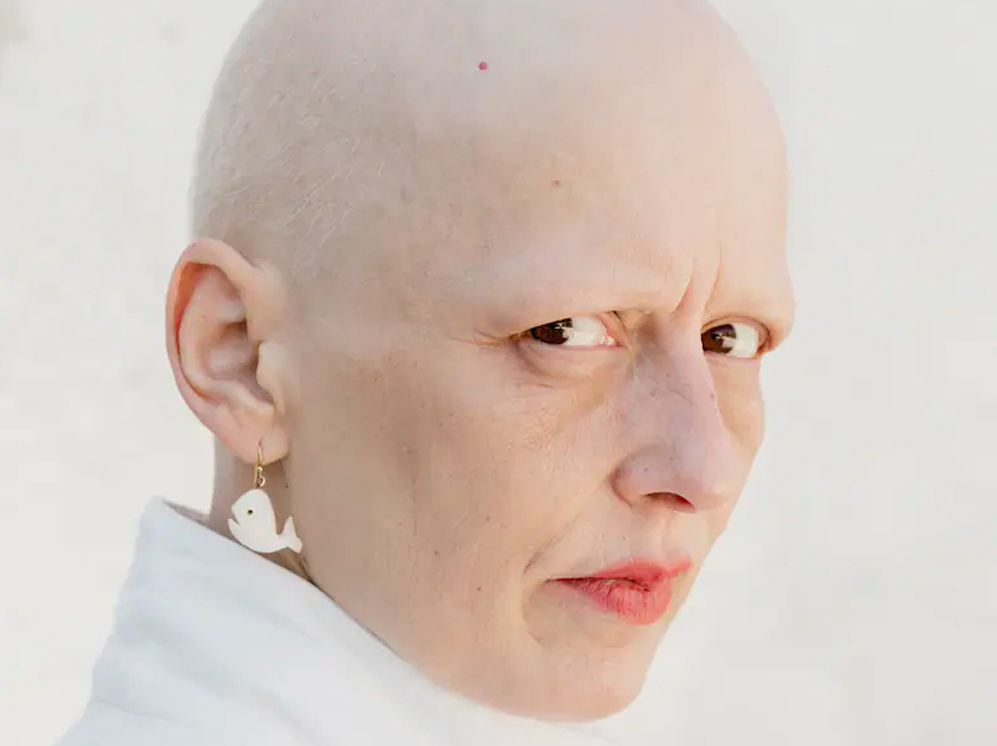 Fleur Breteau présente “Cancer colère”. 